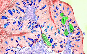Nature新研究解答爭議，為炎癥性疾病的免疫機制提供新見解