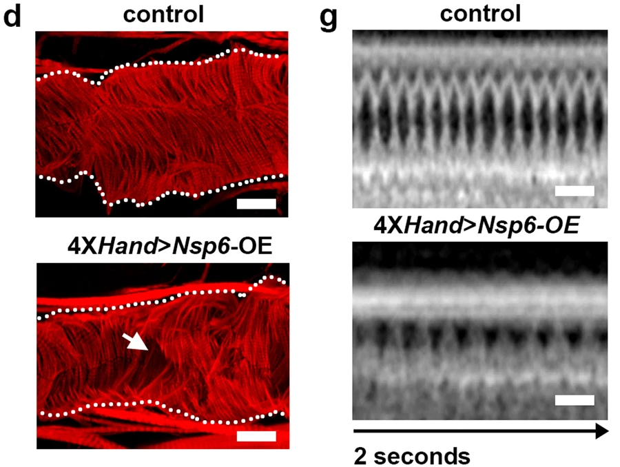 UAS-SARS-CoV-2Nsp6轉(zhuǎn)基因的4XH和Gal4、成纖維細(xì)胞特異性過(guò)表達(dá)（OE）誘導(dǎo)的成人心臟表型
