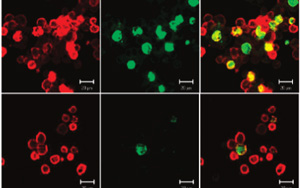 Nature Aging：觸發(fā)大腦的免疫細胞可以減緩阿爾茨海默病