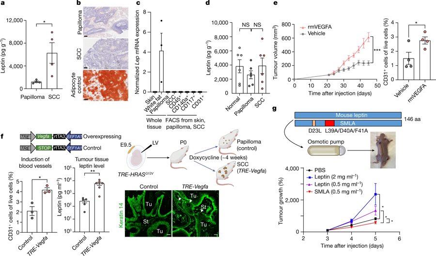 惡性腫瘤微環(huán)境中瘦素水平升高，是由血管生成增加引起的