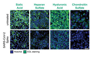 加州伯克利大學發(fā)現(xiàn)“病毒毒素”可導致重癥COVID-19