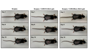 CAR-T細胞療法再獲突破！有效清除術(shù)后殘留癌細胞、預(yù)防腫瘤復(fù)發(fā)，即將開展臨床試驗