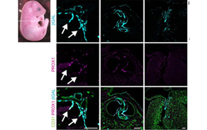 《Nature》淋巴系統(tǒng)潛在的新功能——造血！