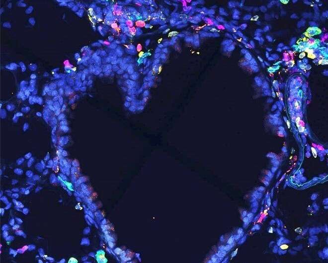 免疫染色AM ILC2 免疫染色AM ILC2