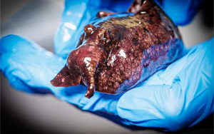 神經(jīng)信號調(diào)節(jié)新發(fā)現(xiàn)：L-或D-氨基酸？鏡像分子可改變神經(jīng)元的信號！