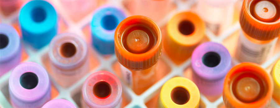 總蛋白檢測(cè) 總蛋白檢測(cè)