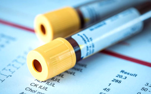 谷胱甘肽還原酶（GR）檢測(cè)試劑盒用原輔料