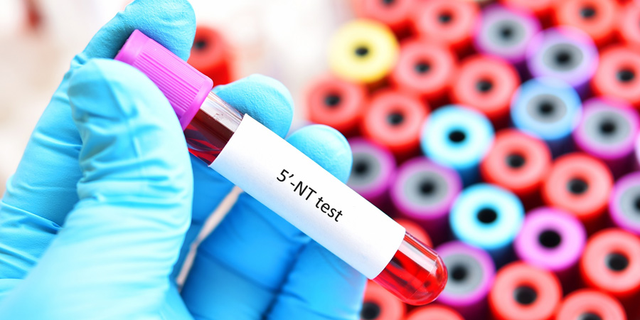 5'-核糖核苷酸磷酸水解酶檢測(cè)