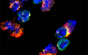 《Nature Immunology》兩種不同類型的免疫細胞幫助20億人控制結(jié)核病