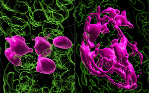 黑發(fā)原來是這樣變白的！Nature最新研究發(fā)現(xiàn)逆轉白發(fā)的關鍵所在
