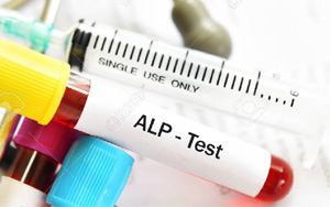 堿性磷酸酶（ALP/AKP）檢測(cè)試劑盒用原輔料