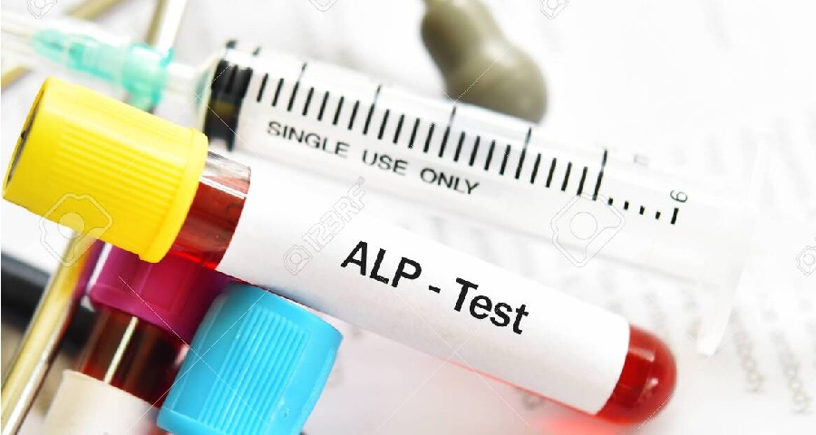 堿性磷酸酶檢測(cè)