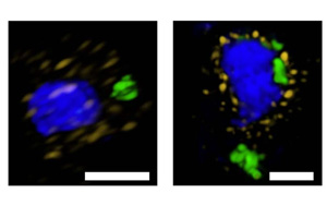 Nature子刊改變游戲規(guī)則：一種以前未知的細胞途徑