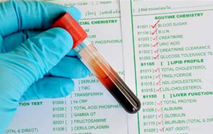 谷氨酸脫氫酶（GLDH/GDH）檢測(cè)試劑盒用原輔料