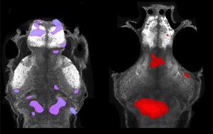 自閉癥相關基因集中在小膠質(zhì)細胞和多巴胺上