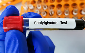 甘膽酸（CG）檢測(cè)試劑盒用原輔料