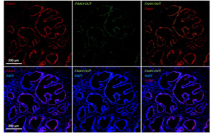 一種罕見基因突變，感覺不到疼痛！新研究揭示其獨特的分子機制