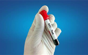 γ-谷氨酰轉(zhuǎn)移酶（γ-GT）檢測(cè)試劑盒用原輔料