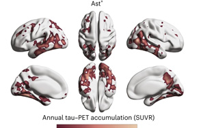 《Nature Medicine》阿爾茲海默癥新的血液生物標(biāo)志物