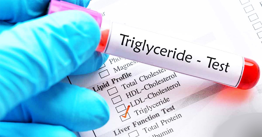 甘油三酯（TG）檢測
