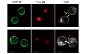 是什么決定了CD8+ T細(xì)胞的命運(yùn)？Immunity新研究指向cBAF復(fù)合物