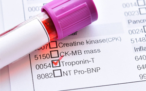 心肌肌鈣蛋白T（cTnT）-磁微?；瘜W(xué)發(fā)光法（吖啶酯） /熒光免疫層析解決方案