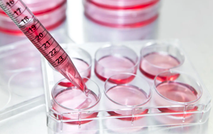 細胞培養(yǎng)的根本-細胞株/細胞系