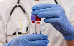 肌酸激酶同工酶（CK-MB）-磁微?；瘜W法學發(fā)光（AE/AP） /熒光免疫層析解決方案