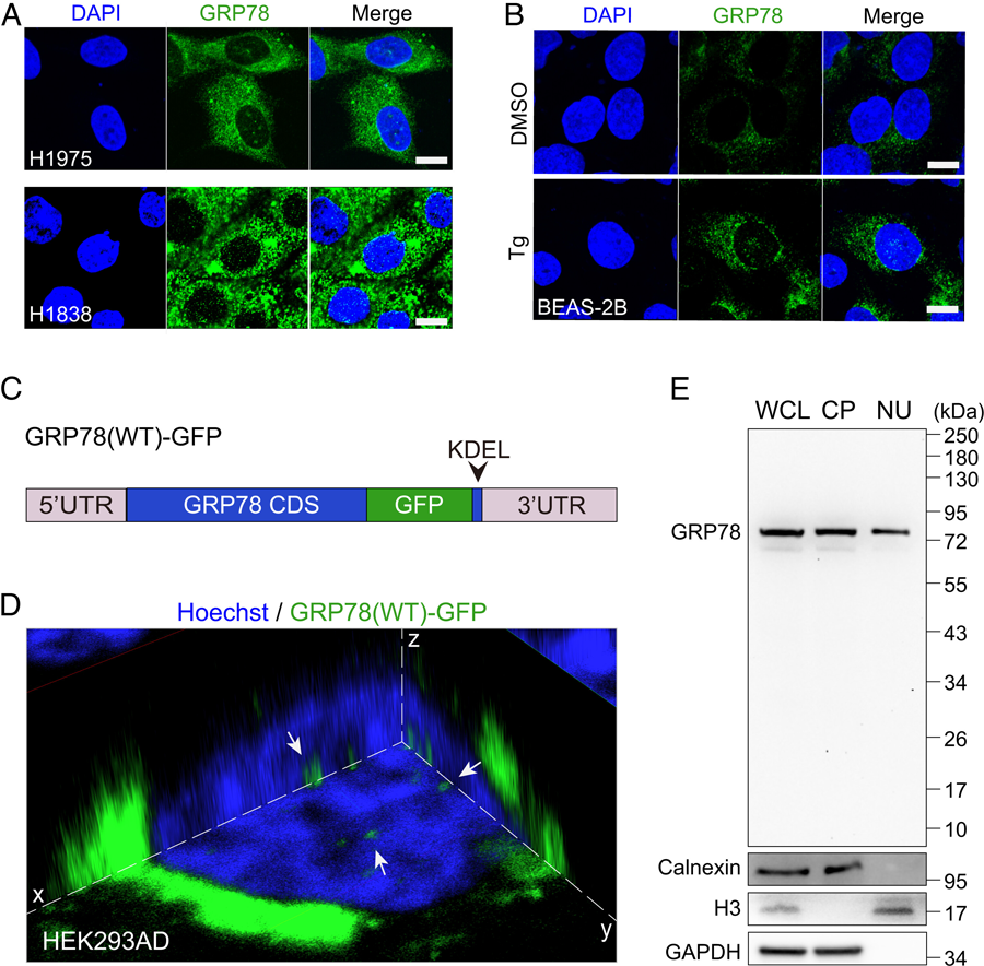 GRP78定位于人癌癥細(xì)胞和內(nèi)質(zhì)網(wǎng)應(yīng)激細(xì)胞的細(xì)胞核。