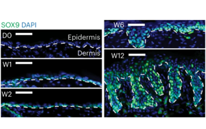 Nature子刊新研究為癌癥如何破壞干細胞精心調(diào)整的表觀過程提供了新見解