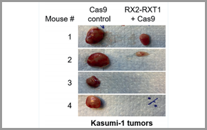 Leukemia：基于CRISPR的基因療法為白血病治療帶來希望
