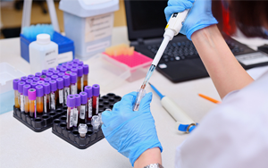 可溶性生長(zhǎng)刺激表達(dá)基因2蛋白（ST2）- 磁微?；瘜W(xué)發(fā)光法（吖啶酯）/熒光免疫層析解決方案