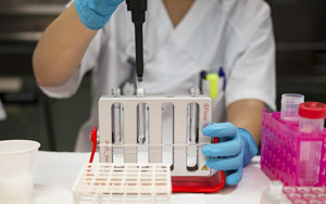 糖鏈抗原19-9(CA19-9)-磁微?；瘜W(xué)發(fā)光（吖啶酯）解決方案