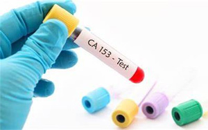 糖類抗原15-3(CA15-3)-磁微粒化學發(fā)光法（AE/AP）解決方案