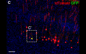 《Neuron》科學家發(fā)現腦力更新的生物標志物