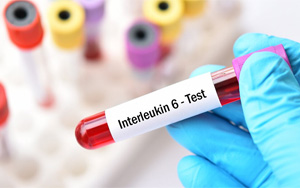 白介素-6（IL-6）-磁微?；瘜W(xué)發(fā)光（吖啶酯） /熒光免疫層析解決方案