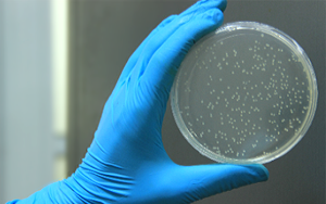 去除融合蛋白標(biāo)簽的選項TEV蛋白酶——看這里