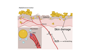 Cell：首次證明一種常見(jiàn)的皮膚細(xì)菌可以通過(guò)直接作用于神經(jīng)細(xì)胞而引起瘙癢