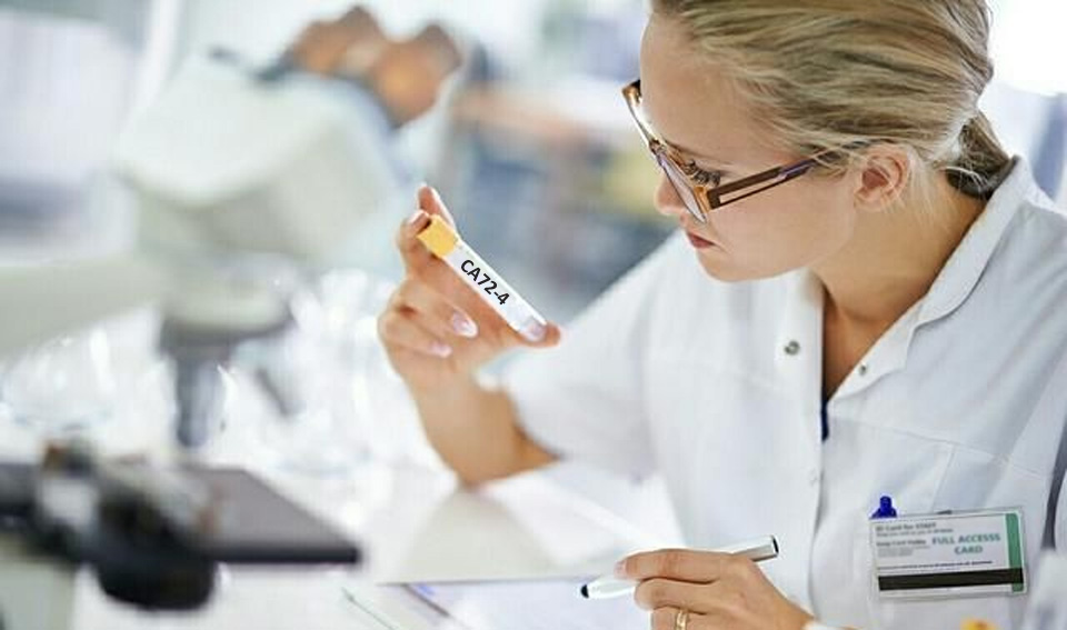 糖類抗原72-4（CA72-4）-磁微?；瘜W(xué)發(fā)光（吖啶酯）
解決方案