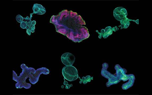 再生醫(yī)學(xué)的未來，到類器官的世界中去