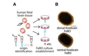 《Cell》新型組織衍生的大腦類器官可能會(huì)給大腦研究帶來(lái)革命性的變化