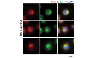 Nature子刊：開(kāi)創(chuàng)性的將化學(xué)探針引入活細(xì)胞，靶向紅斑狼瘡