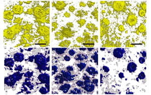 Nature：光和聲可以清除阿爾茨海默氏癥小鼠的淀粉樣蛋白！