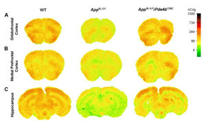 發(fā)現(xiàn)阿爾茨海默病的新治療靶點PDE4B 活性降低27%可大大挽救AD小鼠記憶、大腦功能和炎癥