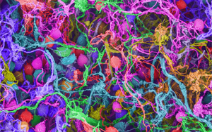 Nature：要想形成長期記憶，必須有DNA損傷和腦部炎癥？！