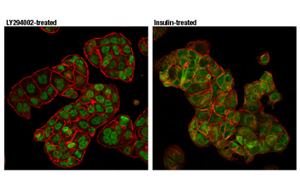 Nature最新發(fā)現(xiàn)控制CAR-T細胞壽命的蛋白質(zhì)！