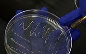 《Nature》科學(xué)家揭開(kāi)了一種致命霍亂病菌背后的神秘面紗